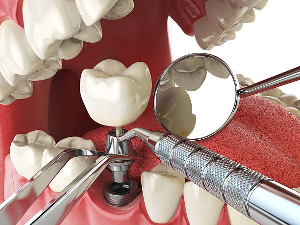 Best Emergency Denture Repair in Enochville, NC