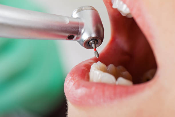 Best Emergency Dental Care for Broken or Chipped Teeth in Enochville, NC
